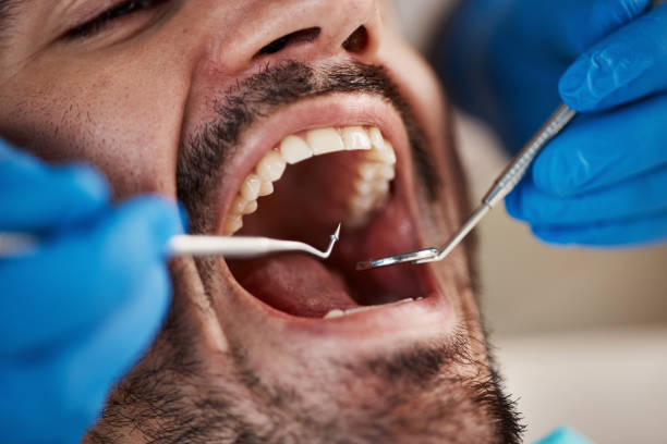 Dentist for Dental Trauma in NC